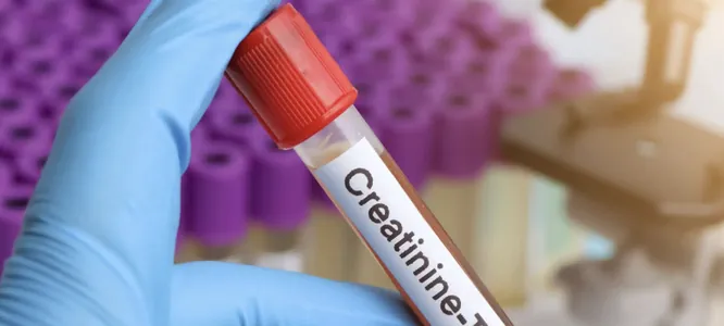 A blood sample tube labelled Creatinine Test