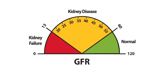 A gauge showing GFR ranges from kidney failure to normal